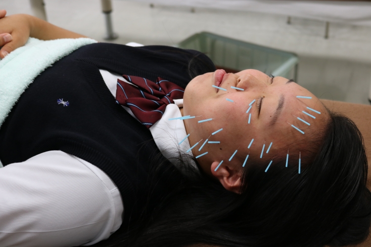 鍼灸学科　美容鍼体験