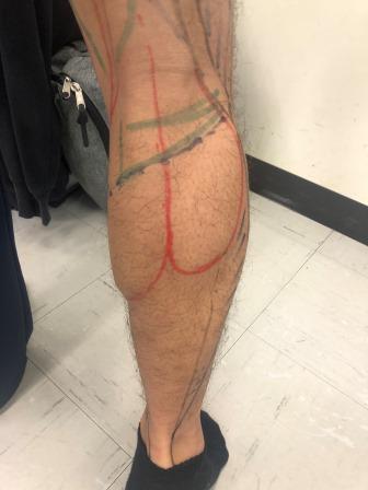体表に投影した下肢の筋肉1