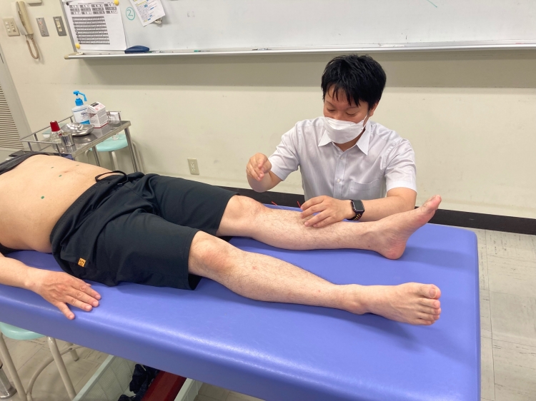 遠隔部に刺鍼法を指導